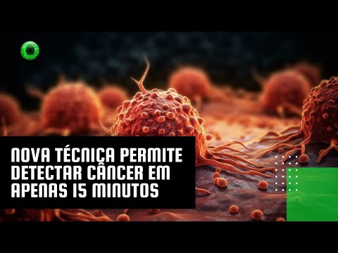 Nova técnica permite detectar câncer em apenas 15 minutos