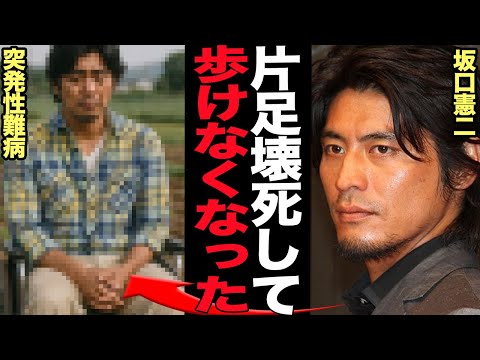 ニュースの動画サムネイル - 坂口憲二が片足壊死で芸能界引退に追い込まれた難病・特発性大腿骨頭壊死症の真相に思わず絶句…！歩くこともままならない状態で事務所を退所、原因不明の病で追い込まれた過酷な闘病生活に言葉を失う【芸能】