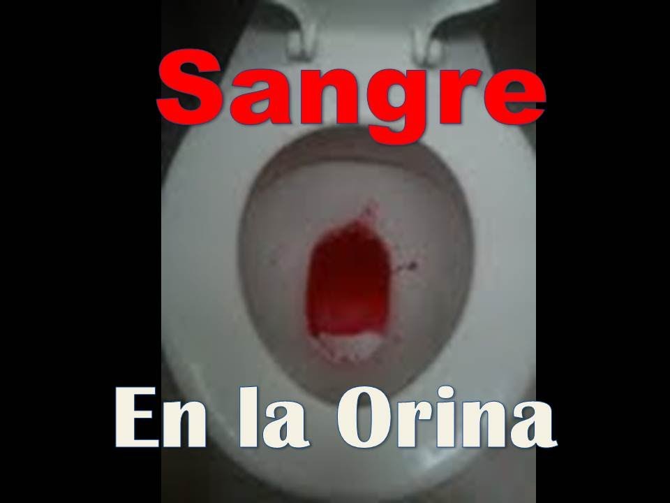 Infeccion De Orina Con Sangre Petrus Maximinus