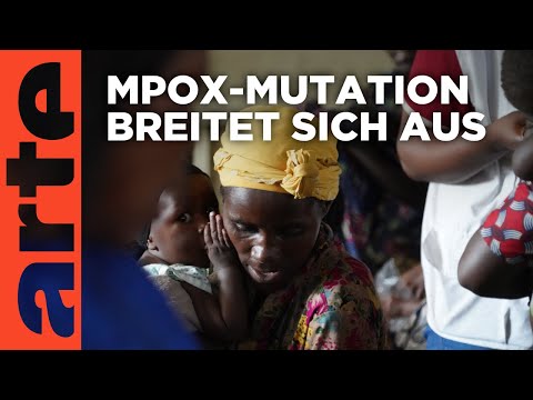 DR Kongo: Die Mpox-Epidemie | ARTE Reportage