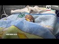 Children in Gaza are dying of malnutrition  - 01:51 min - News - Video