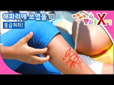 삐뽀삐뽀! 우리 몸 X파일 - 해파리에 쏘였어요_#001