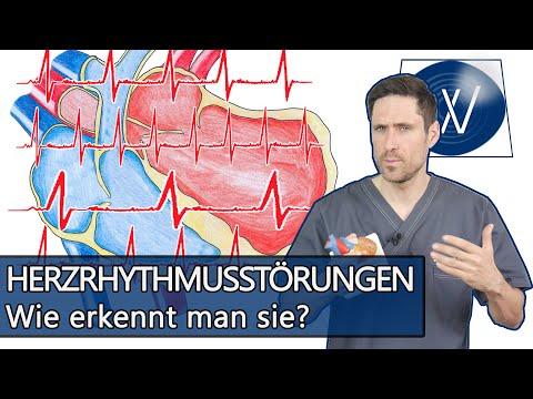 Herzrhythmusstörungen: Von Vorhofflimmern bis unregelmäßige Herzschläge - Symptome, Folgen, Therapie