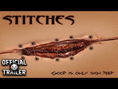 Stitches'