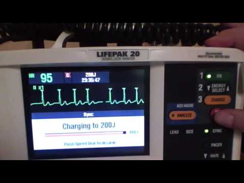 Demonstration of electrical cardioversion on a patient with atrial fibrillation. Demonstration of electrical cardioversion on a patient with atrial fibrillation.