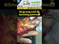 చేప ఫ్రై ముక్క ఓపెన్ చేస్తే  కదులుతున్న పురుగులు😱 | Worms in Fish Fry Viral Video | Prime9 News  - 00:11 min - News - Video