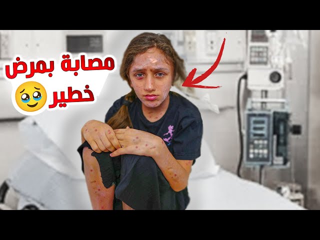 مرض خطير مع جنى دعواتكم😭💔🤲